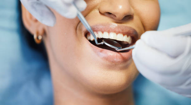 Best Emergency Root Canal Treatment in Jefferson, IA