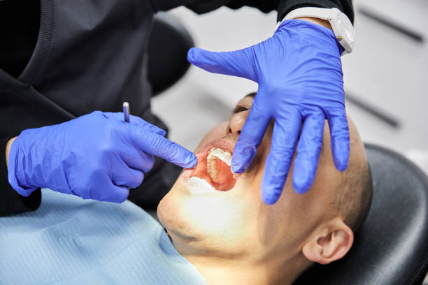 Best Emergency Root Canal Treatment in Jefferson, IA